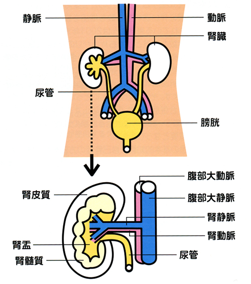 人工透析