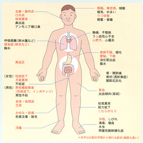 人工透析