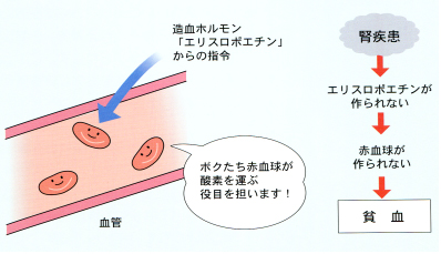 人工透析