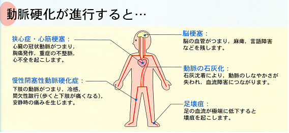 人工透析